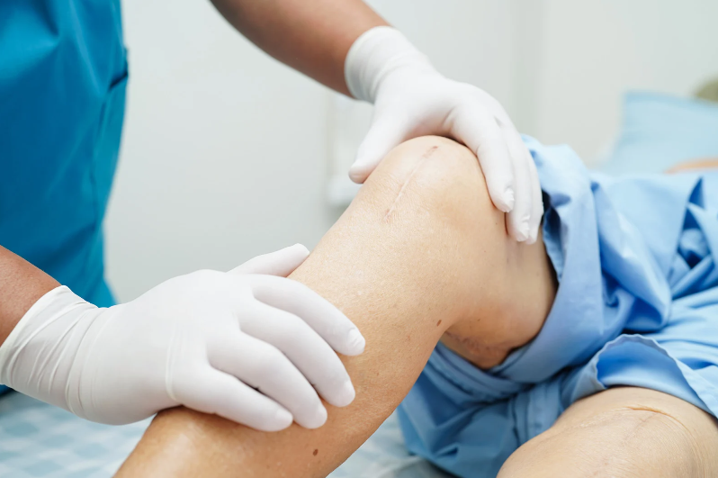 Affordable Knee Surgery How to Access Quality Care Without Breaking the Bank