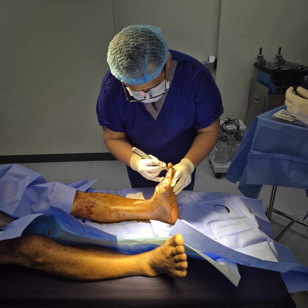 Where to Find Trusted Debridement Services in Quezon City
